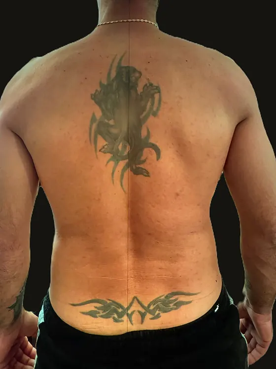 Dos avant recouvrement, deux anciens tatouages de 15 ans